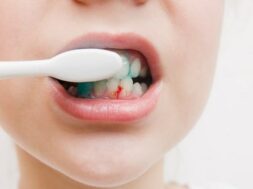 Causes-and-home-remedies-for-gum-bleeding-min