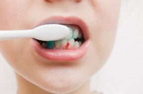 Causes-and-home-remedies-for-gum-bleeding-min