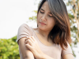 Asian,Woman,Scratching,Her,Arm;,Concept,Of,Dry,Skin,,Allergic